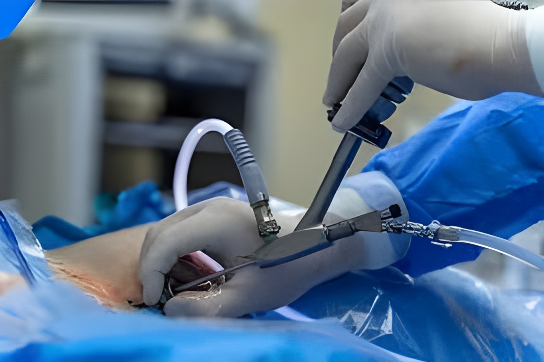 Endoscopic Procedures